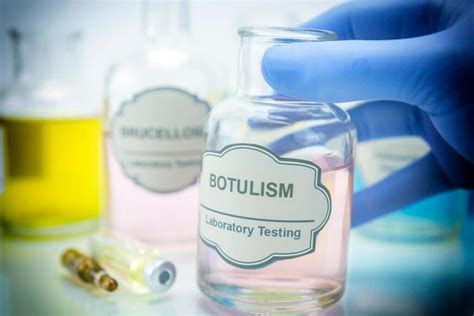 what are the treatment options for botulism